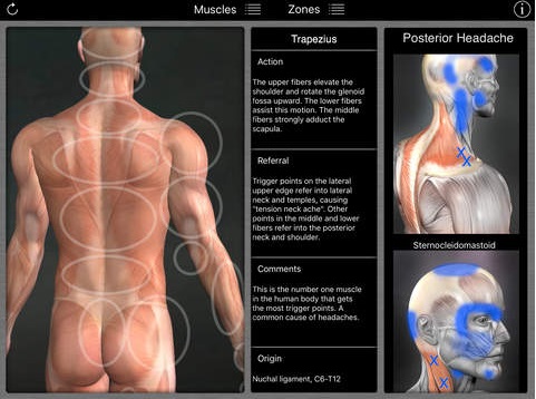 Muscle trigger points by area of pain